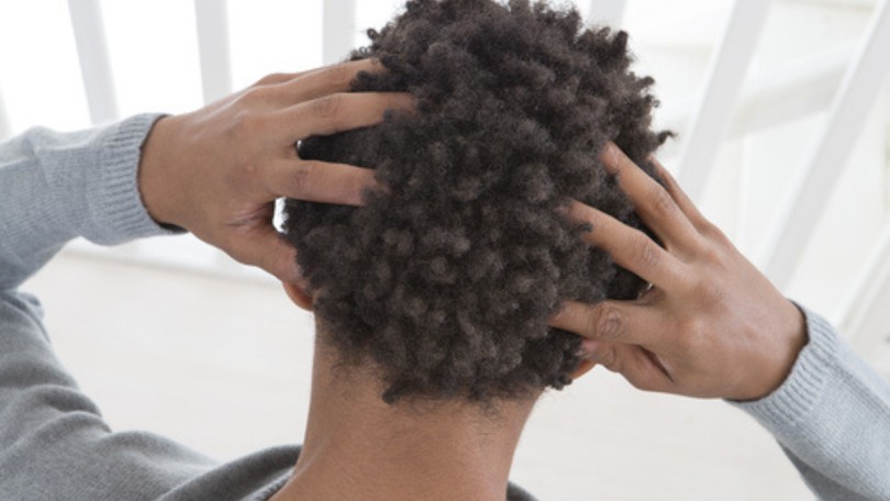 Dandruff